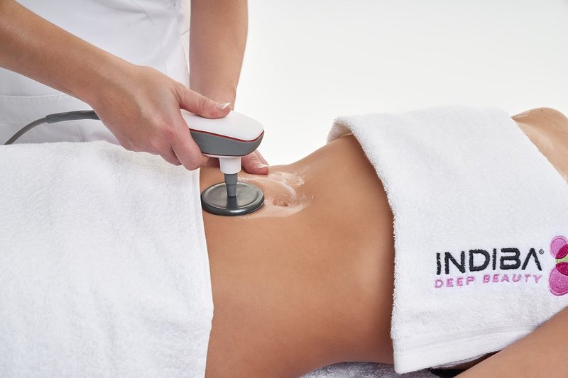 Sala de tratamiento INDIBA en Quirosalut